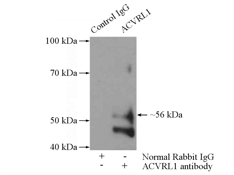 IP Result of anti-ACVRL1 (IP:Catalog No:107755, 4ug; Detection:Catalog No:107755 1:300) with Jurkat cells lysate 2400ug.
