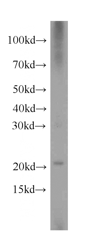 PC-3 cells were subjected to SDS PAGE followed by western blot with Catalog No:111348(C11orf73 antibody) at dilution of 1:500