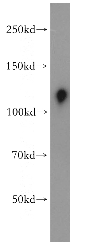 K-562 cells were subjected to SDS PAGE followed by western blot with Catalog No:116680(USP38 antibody) at dilution of 1:500