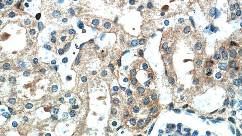 Immunohistochemical of paraffin-embedded human kidney using Catalog No:110721(FZD10 antibody) at dilution of 1:100 (under 40x lens)
