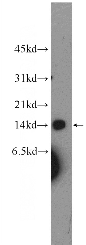 HEK-293 cells were subjected to SDS PAGE followed by western blot with Catalog No:116632(C6orf125 Antibody) at dilution of 1:600