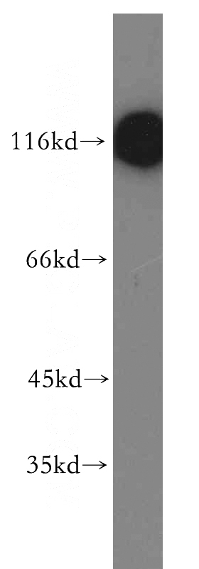 human skeletal muscle tissue were subjected to SDS PAGE followed by western blot with Catalog No:112678(MAP3K10 antibody) at dilution of 1:300