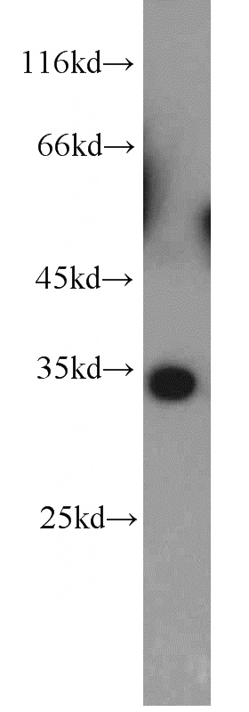 mouse testis tissue were subjected to SDS PAGE followed by western blot with Catalog No:109353(CNOT7 antibody) at dilution of 1:500