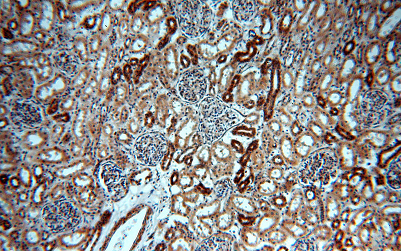 Immunohistochemical of paraffin-embedded human kidney using Catalog No:107780(ADCY3 antibody) at dilution of 1:100 (under 10x lens)