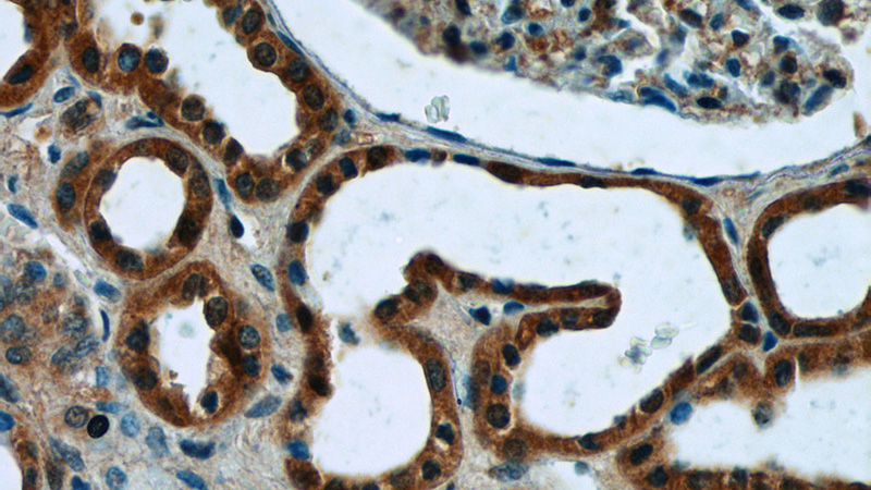 Immunohistochemistry of paraffin-embedded human kidney tissue slide using Catalog No:112823(MRPL33 Antibody) at dilution of 1:50 (under 40x lens)