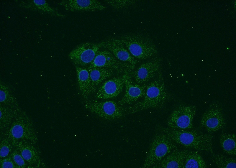 Immunofluorescent analysis of SH-SY5Y cells using Catalog No:116704(VAMP1 Antibody) at dilution of 1:50 and Alexa Fluor 488-congugated AffiniPure Goat Anti-Rabbit IgG(H+L)