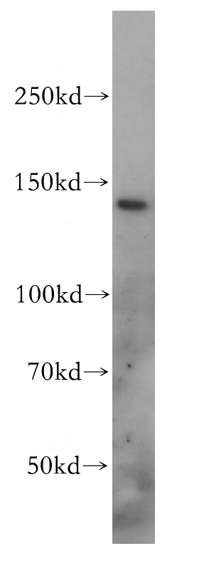 mouse liver tissue were subjected to SDS PAGE followed by western blot with Catalog No:115350(SLC9A11 antibody) at dilution of 1:500