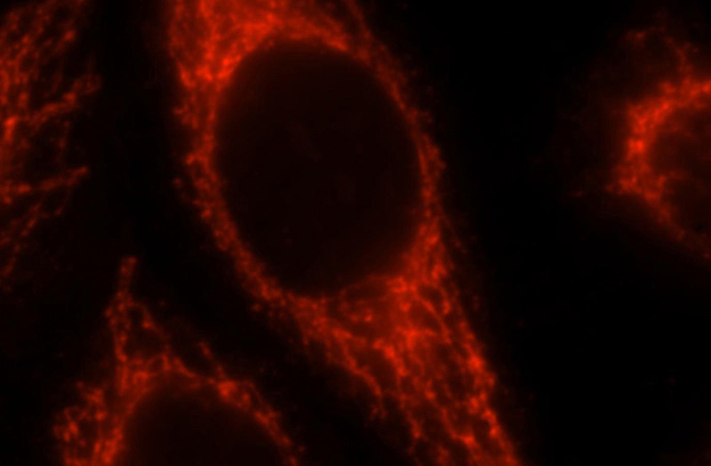 Immunofluorescent analysis of Hela cells, using SEC24A antibody Catalog No:115079 at 1:25 dilution and Rhodamine-labeled goat anti-rabbit IgG (red).