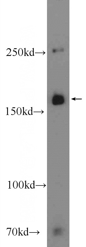 mouse brain tissue were subjected to SDS PAGE followed by western blot with Catalog No:109629(CUX2 Antibody) at dilution of 1:300