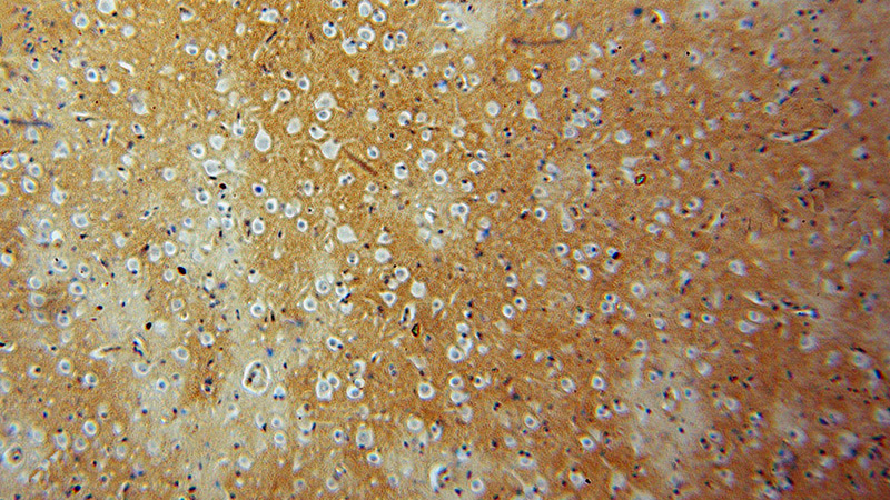 Immunohistochemical of paraffin-embedded human brain using Catalog No:110735(FN3KRP antibody) at dilution of 1:50 (under 10x lens)