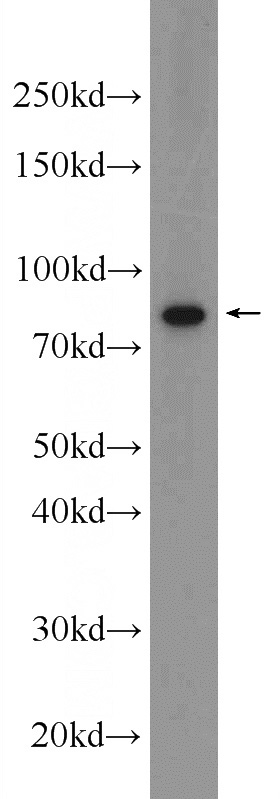 K-562 cells were subjected to SDS PAGE followed by western blot with Catalog No:109619(CSTF3 Antibody) at dilution of 1:600