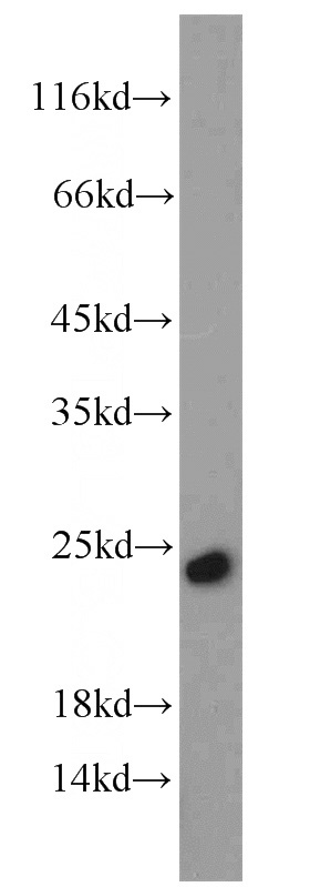HepG2 cells were subjected to SDS PAGE followed by western blot with Catalog No:116340(TRAPB, SSR2 antibody) at dilution of 1:1000