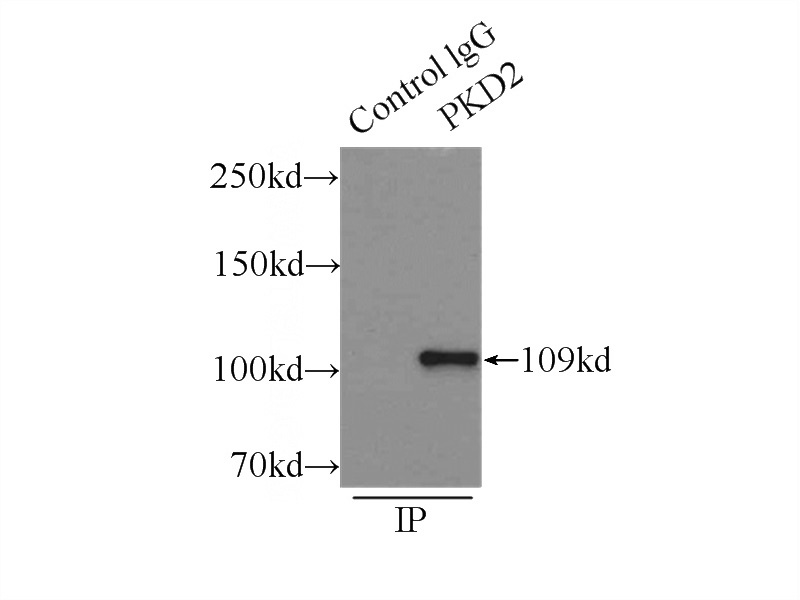 IP Result of anti-PKD2 (IP:Catalog No:114055, 3ug; Detection:Catalog No:114055 1:500) with mouse testis tissue lysate 8000ug.