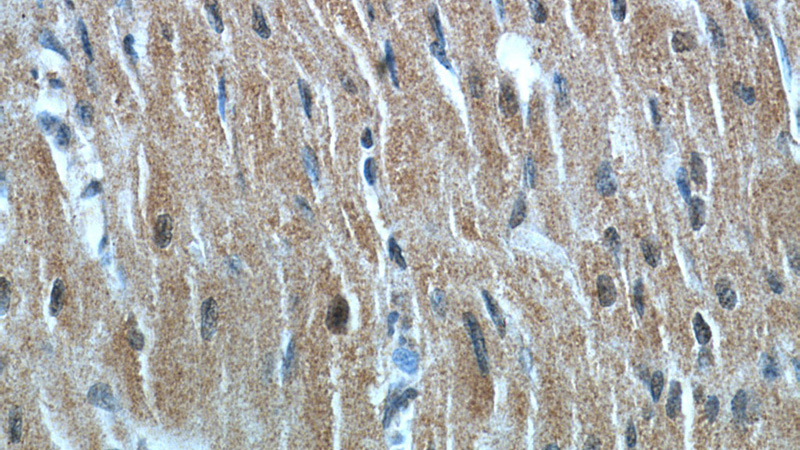 Immunohistochemical of paraffin-embedded human heart using Catalog No:113178(NHLRC1 antibody) at dilution of 1:50 (under 40x lens)