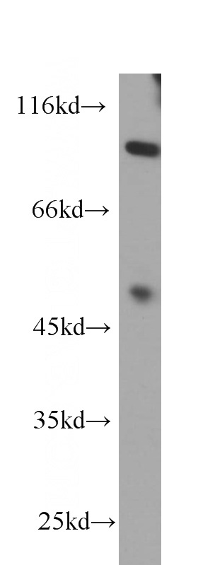 human brain tissue were subjected to SDS PAGE followed by western blot with Catalog No:107472(PIK3R1 antibody) at dilution of 1:1000
