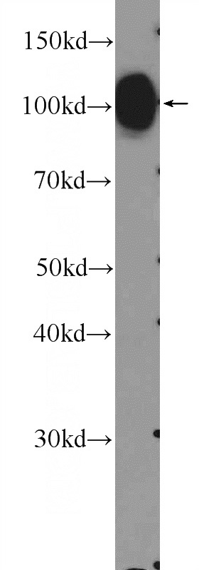 mouse spinal cord tissue were subjected to SDS PAGE followed by western blot with Catalog No:112375(MAG Antibody) at dilution of 1:600