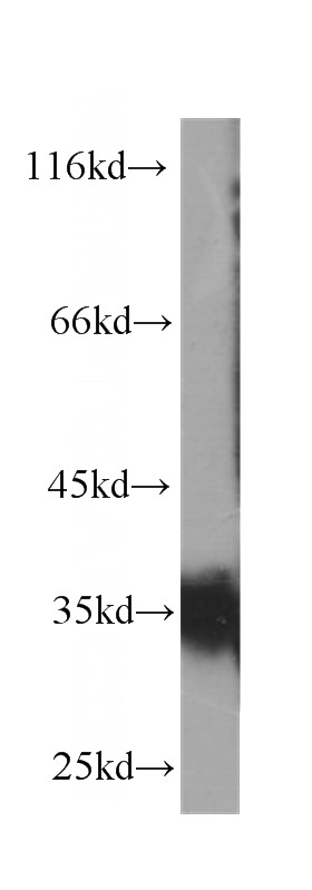Jurkat cells were subjected to SDS PAGE followed by western blot with Catalog No:107142(CD7 antibody) at dilution of 1:1000