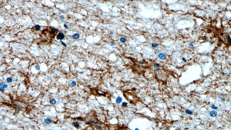 Immunohistochemical of paraffin-embedded human brain using Catalog No:108047(AQP4 antibody) at dilution of 1:50 (under 40x lens)