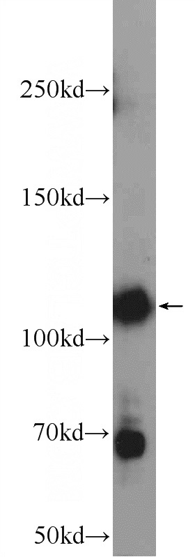 HeLa cells were subjected to SDS PAGE followed by western blot with Catalog No:117178(ZNF451 Antibody) at dilution of 1:300