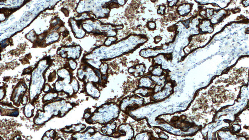 Immunohistochemistry of paraffin-embedded human placenta tissue slide using Catalog No:107882(ALPPL2 Antibody) at dilution of 1:200 (under 10x lens).