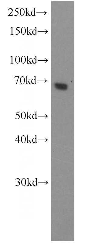 HeLa cells were subjected to SDS PAGE followed by western blot with Catalog No:107729(ACBD3 antibody) at dilution of 1:1200