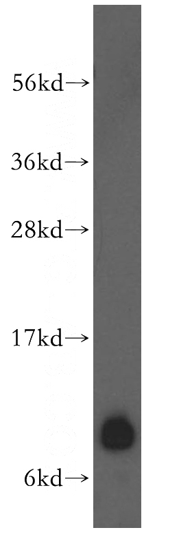 HepG2 cells were subjected to SDS PAGE followed by western blot with Catalog No:114834(RPS21 antibody) at dilution of 1:200