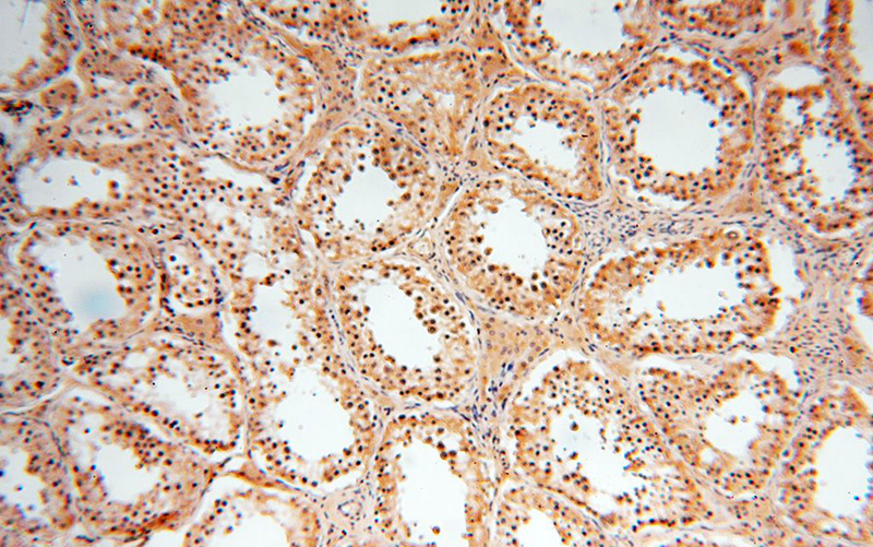 Immunohistochemical of paraffin-embedded human testis using Catalog No:111063(GPD2 antibody) at dilution of 1:100 (under 10x lens)