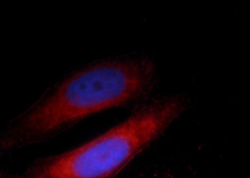 Immunofluorescent analysis of HepG2 cells, using CNOT4 antibody Catalog No:109435 at 1:25 dilution and Rhodamine-labeled goat anti-rabbit IgG (red). Blue pseudocolor = DAPI (fluorescent DNA dye).