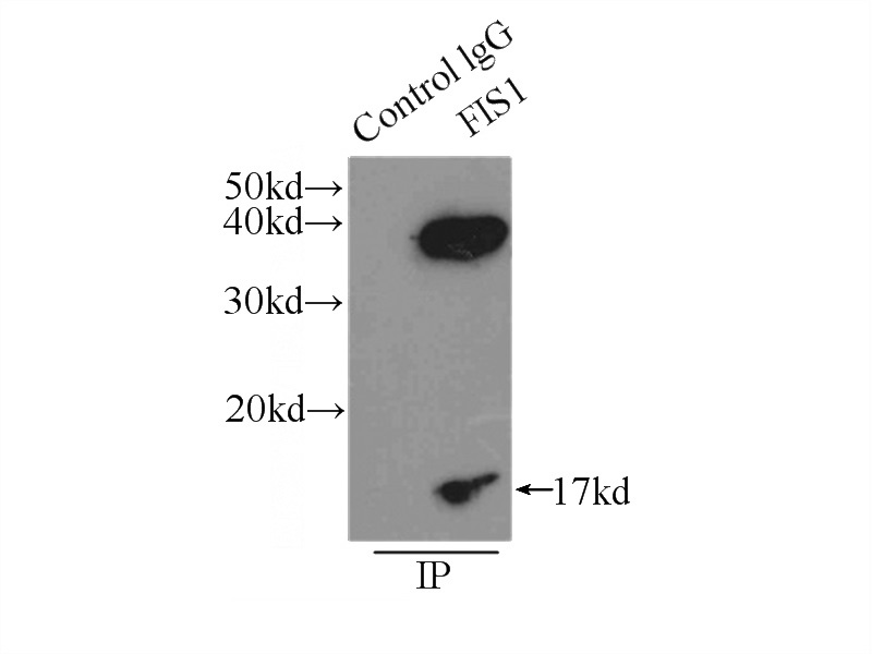 IP Result of anti-FIS1 (IP:Catalog No:110667, 3ug; Detection:Catalog No:110667 1:500) with HeLa cells lysate 3000ug.
