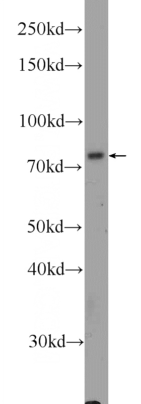 HEK-293 cells were subjected to SDS PAGE followed by western blot with Catalog No:116048(THoc5 Antibody) at dilution of 1:600