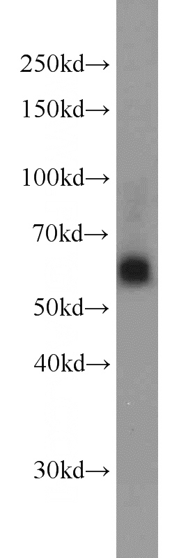 HeLa cells were subjected to SDS PAGE followed by western blot with Catalog No:115284(SIAH1 antibody) at dilution of 1:300