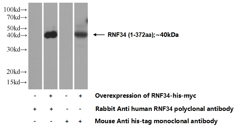 Transfected HEK-293 cells were subjected to SDS PAGE followed by western blot with Catalog No:114757(RNF34 Antibody) at dilution of 1:1000