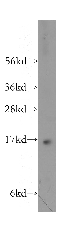 A549 cells were subjected to SDS PAGE followed by western blot with Catalog No:114277(PRRG2 antibody) at dilution of 1:300