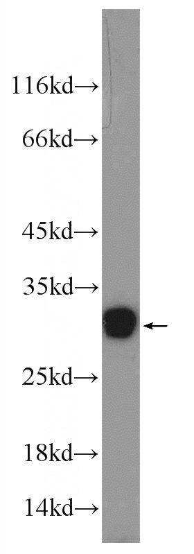 A549 cells were subjected to SDS PAGE followed by western blot with Catalog No:108645(C11orf79 Antibody) at dilution of 1:300