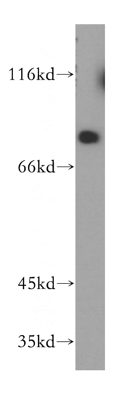 mouse brain tissue were subjected to SDS PAGE followed by western blot with Catalog No:113843(PJA1 antibody) at dilution of 1:200