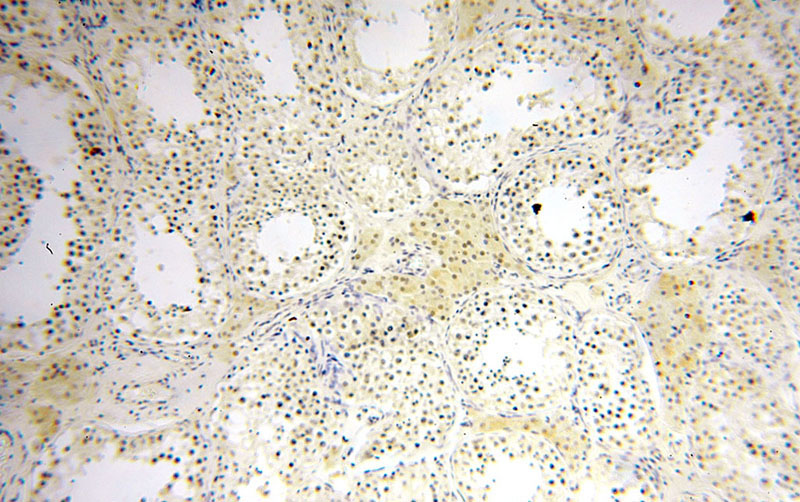 Immunohistochemical of paraffin-embedded human testis using Catalog No:112589(MED28 antibody) at dilution of 1:50 (under 10x lens)