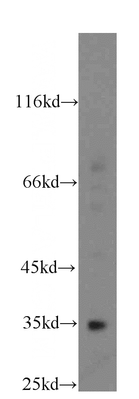 mouse brain tissue were subjected to SDS PAGE followed by western blot with Catalog No:110592(FAM49B antibody) at dilution of 1:500