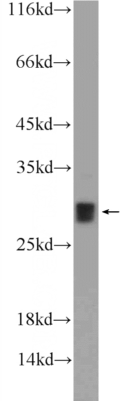 mouse heart tissue were subjected to SDS PAGE followed by western blot with Catalog No:115185(SH3BGR Antibody) at dilution of 1:1000
