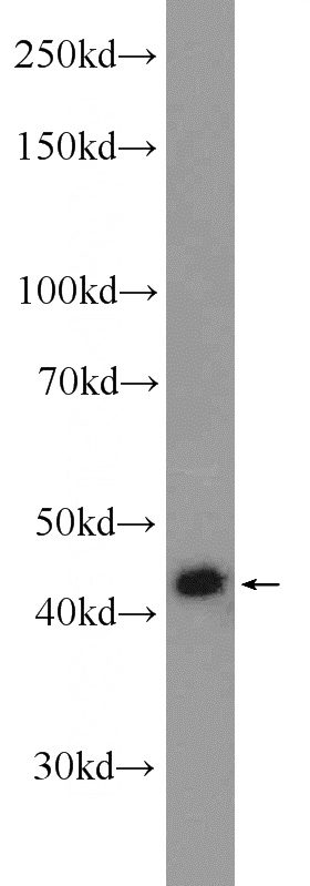 K-562 cells were subjected to SDS PAGE followed by western blot with Catalog No:112669(MKRN2 Antibody) at dilution of 1:1000