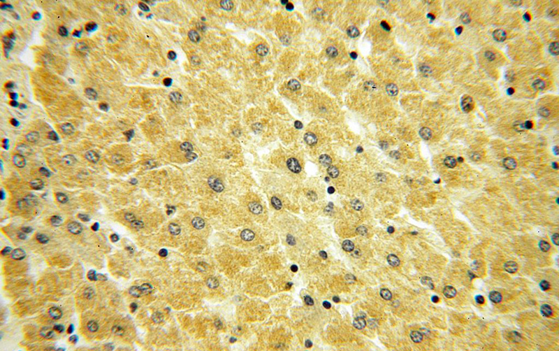 Immunohistochemical of paraffin-embedded human liver using Catalog No:107819(ABLIM1 antibody) at dilution of 1:100 (under 40x lens)