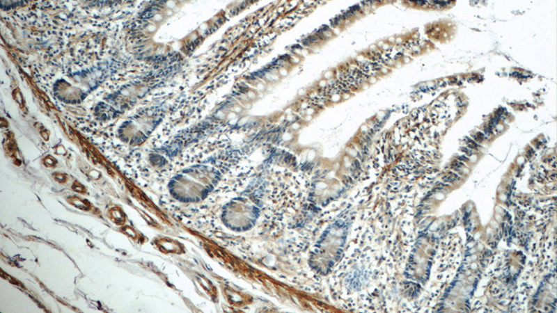 Immunohistochemistry of paraffin-embedded human small intestine tissue slide using Catalog No:112309(LPP Antibody) at dilution of 1:50 (under 10x lens)