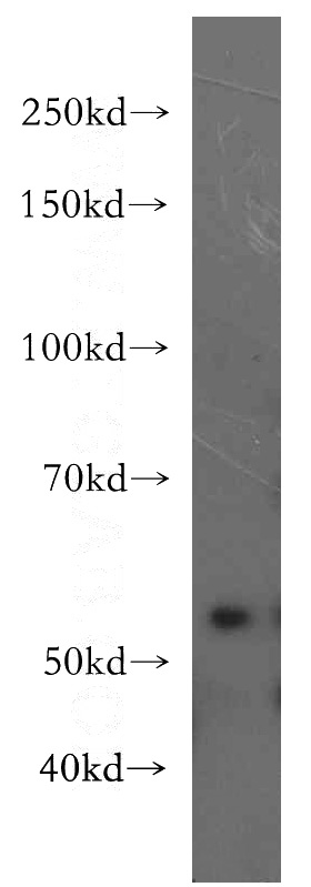 HepG2 cells were subjected to SDS PAGE followed by western blot with Catalog No:116903(ZAK antibody) at dilution of 1:500