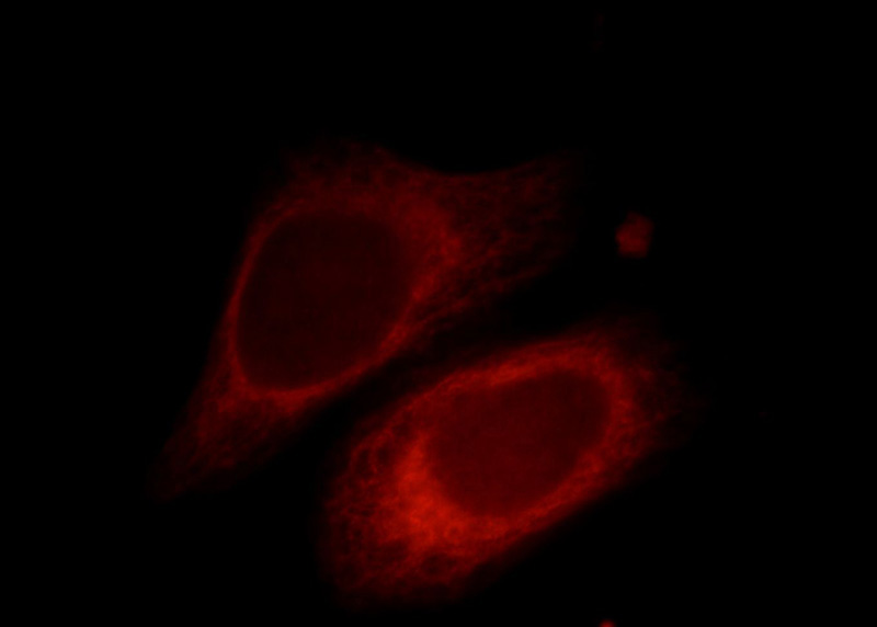 Immunofluorescent analysis of Hela cells, using PRKACB antibody Catalog No:114194 at 1:25 dilution and Rhodamine-labeled goat anti-rabbit IgG (red).