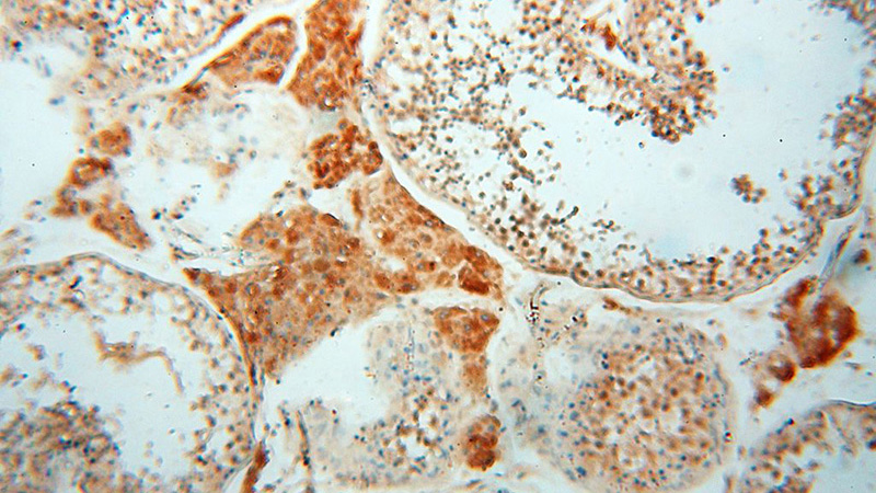 Immunohistochemical of paraffin-embedded human testis using Catalog No:108408(BAG1S-specific antibody) at dilution of 1:50 (under 10x lens)