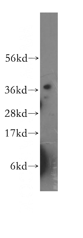 human brain tissue were subjected to SDS PAGE followed by western blot with Catalog No:111036(GLRX3 antibody) at dilution of 1:600