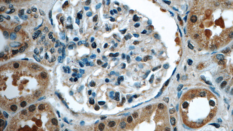 Immunohistochemistry of paraffin-embedded human kidney tissue slide using Catalog No:110413(EXOSC7 Antibody) at dilution of 1:50 (under 40x lens)