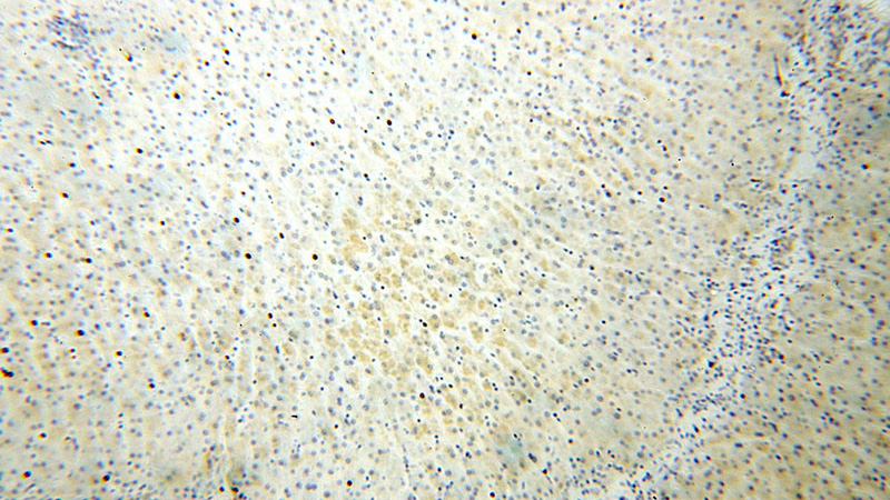 Immunohistochemical of paraffin-embedded human brain using Catalog No:113332(OGDHL antibody) at dilution of 1:100 (under 10x lens)