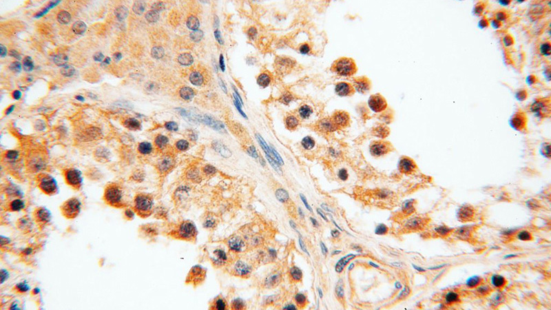Immunohistochemical of paraffin-embedded human testis using Catalog No:111063(GPD2 antibody) at dilution of 1:100 (under 40x lens)
