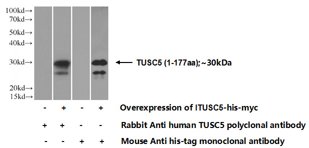 Transfected HEK-293 cells were subjected to SDS PAGE followed by western blot with Catalog No:116497(TUSC5 Antibody) at dilution of 1:1000