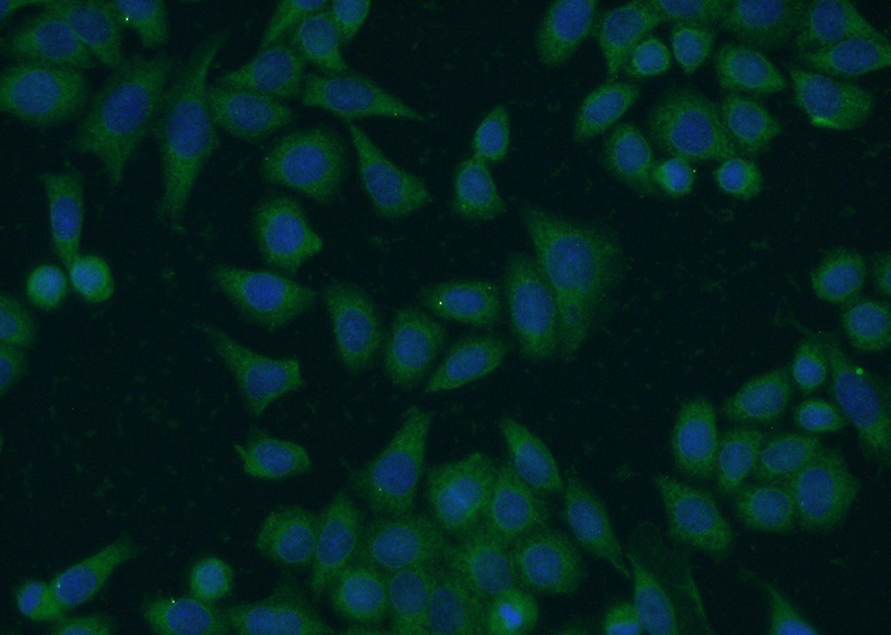 Immunofluorescent analysis of HeLa cells using Catalog No:110735(FN3KRP Antibody) at dilution of 1:50 and Alexa Fluor 488-congugated AffiniPure Goat Anti-Rabbit IgG(H+L)